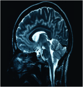 computer scan of a human brain